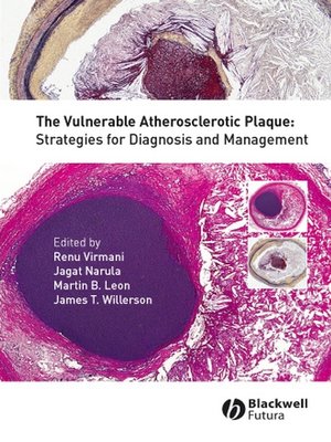 cover image of The Vulnerable Atherosclerotic Plaque